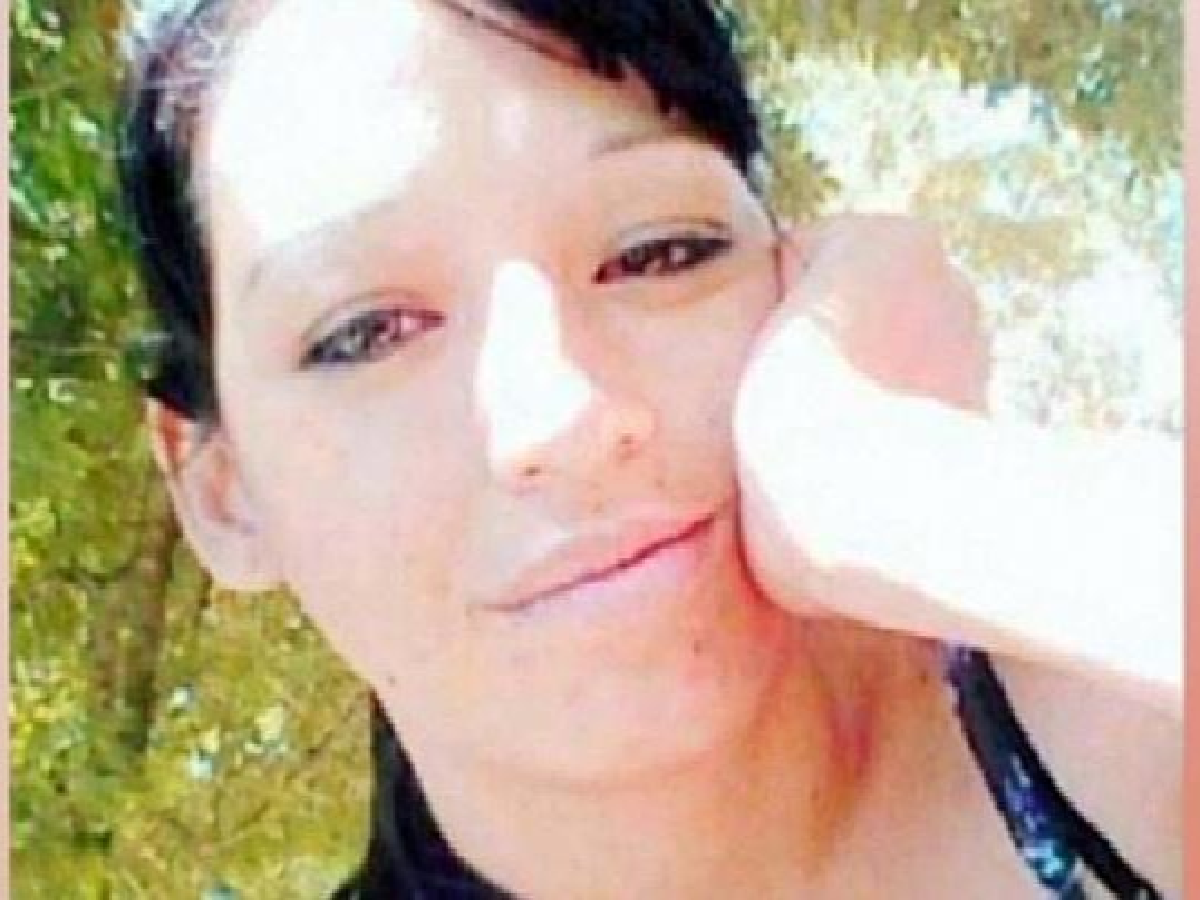 Murió la mujer que sufrió quemaduras en el 90% de su cuerpo tras una ...