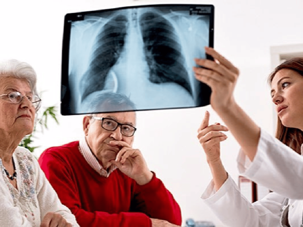 El cáncer de pulmón, el colorrectal y el de mama, los más letales en el país 