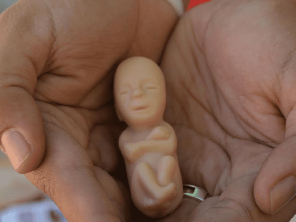 El aborto desde una mirada médica y bioética
