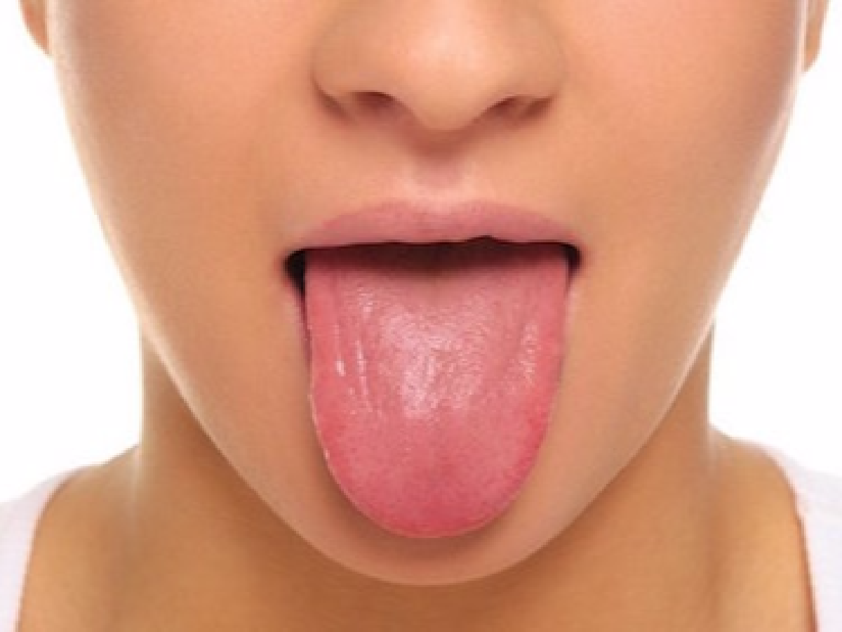 ¿Qué causa que algunas  personas tengan  grietas en la lengua?