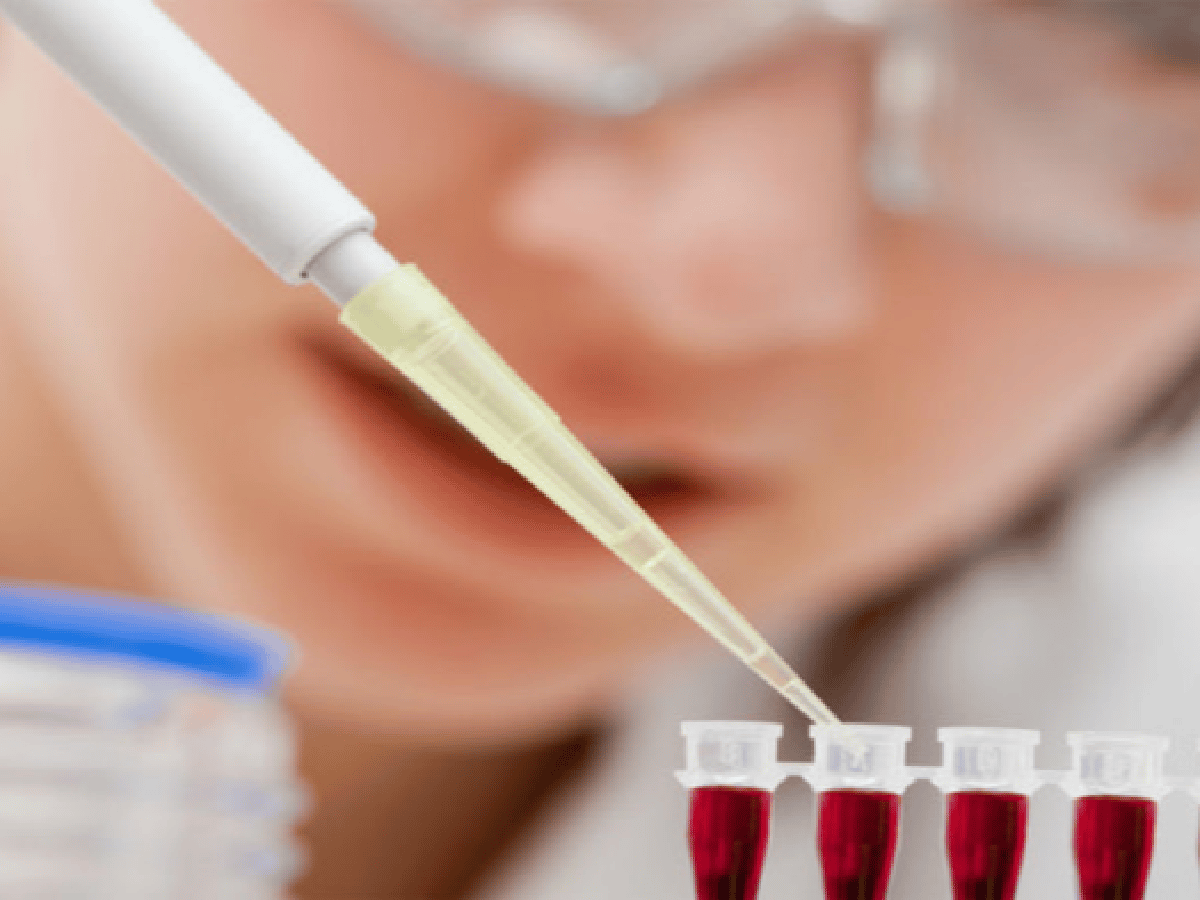 Día mundial de la diabetes: bioquímicos ofrecen análisis gratuitos