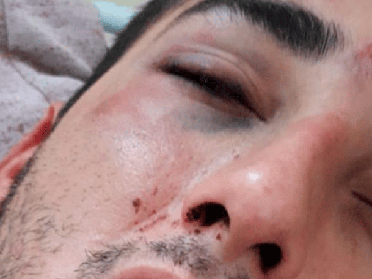 Un hombre sufrió una golpiza feroz y denunció a policías en Río Cuarto