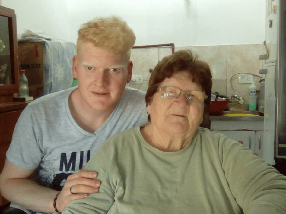   Un proyecto de ley pionero, la esperanza de una familia de albinos de La Francia 