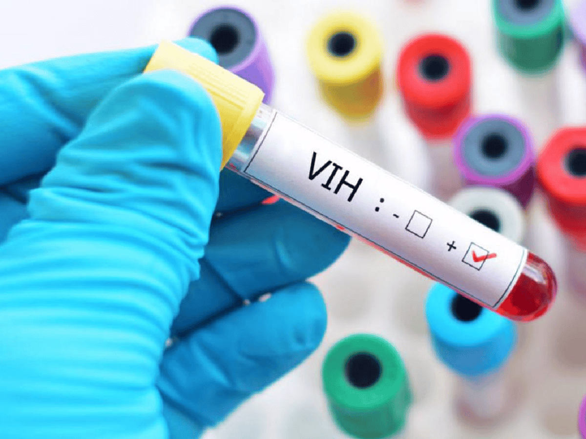 Estiman que la vacuna contra el VIH estará lista en 2023