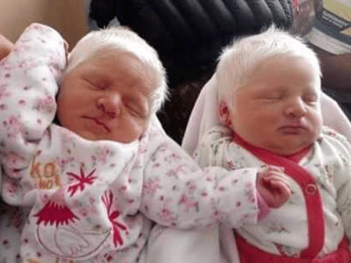 Nacieron mellizas albinas en Tucumán