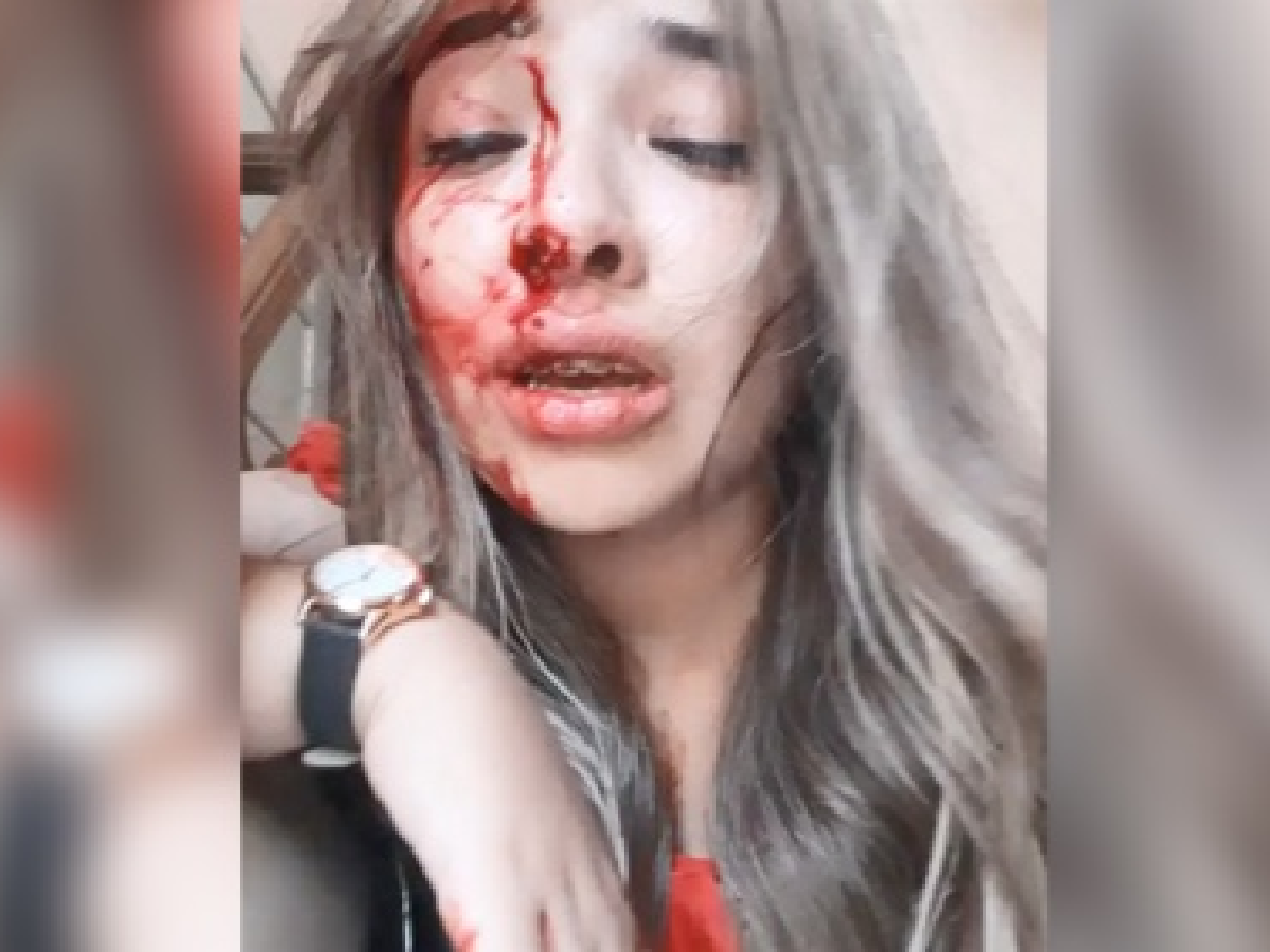 Una joven de María Juana fue brutalmente golpeada por su novio 
