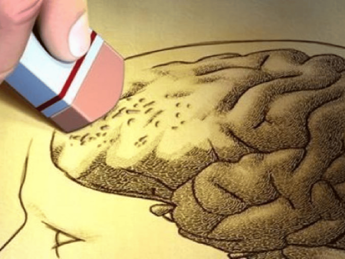 Afirman que el cerebro da "indicios" antes de manifestarse el Alzheimer