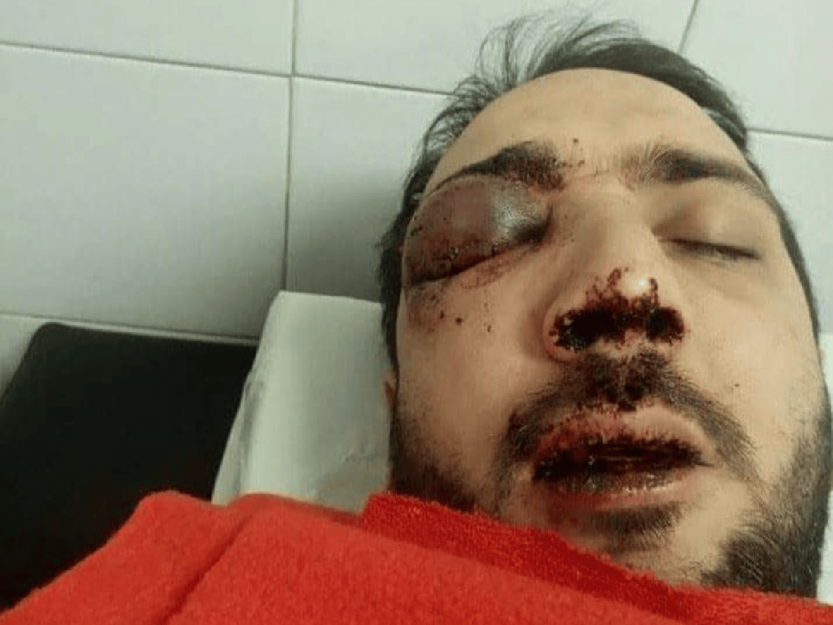 La Plata: un joven denunció brutal paliza de un grupo de patovicas 