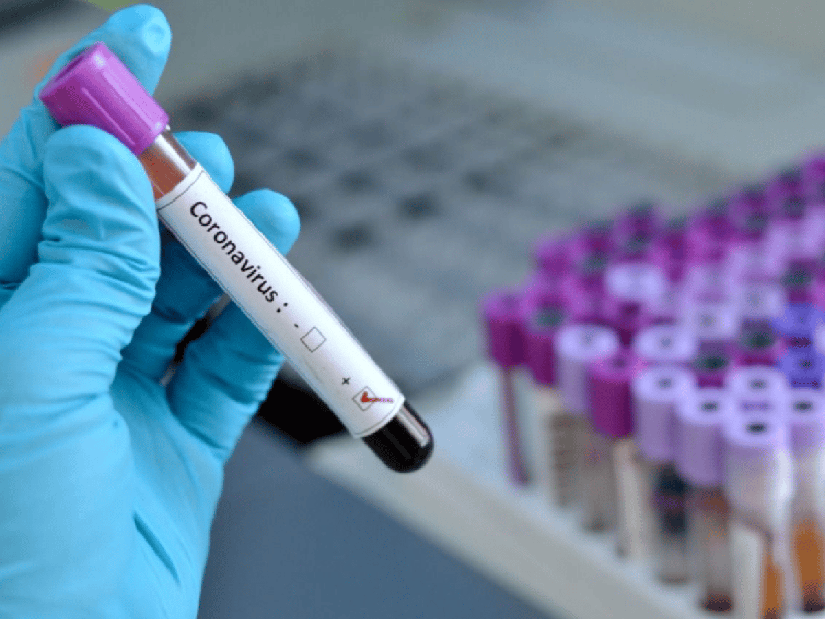Coronavirus en Córdoba: cinco nuevos casos en la provincia y ya suman 22