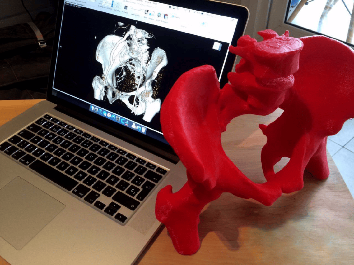 Tecnología 3D, un proyecto para profesionales y pacientes