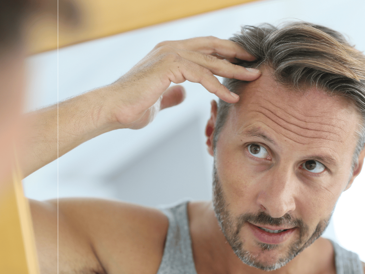 ¿Me quedaré calvo?: cuándo hay que preocuparse por la caída del pelo