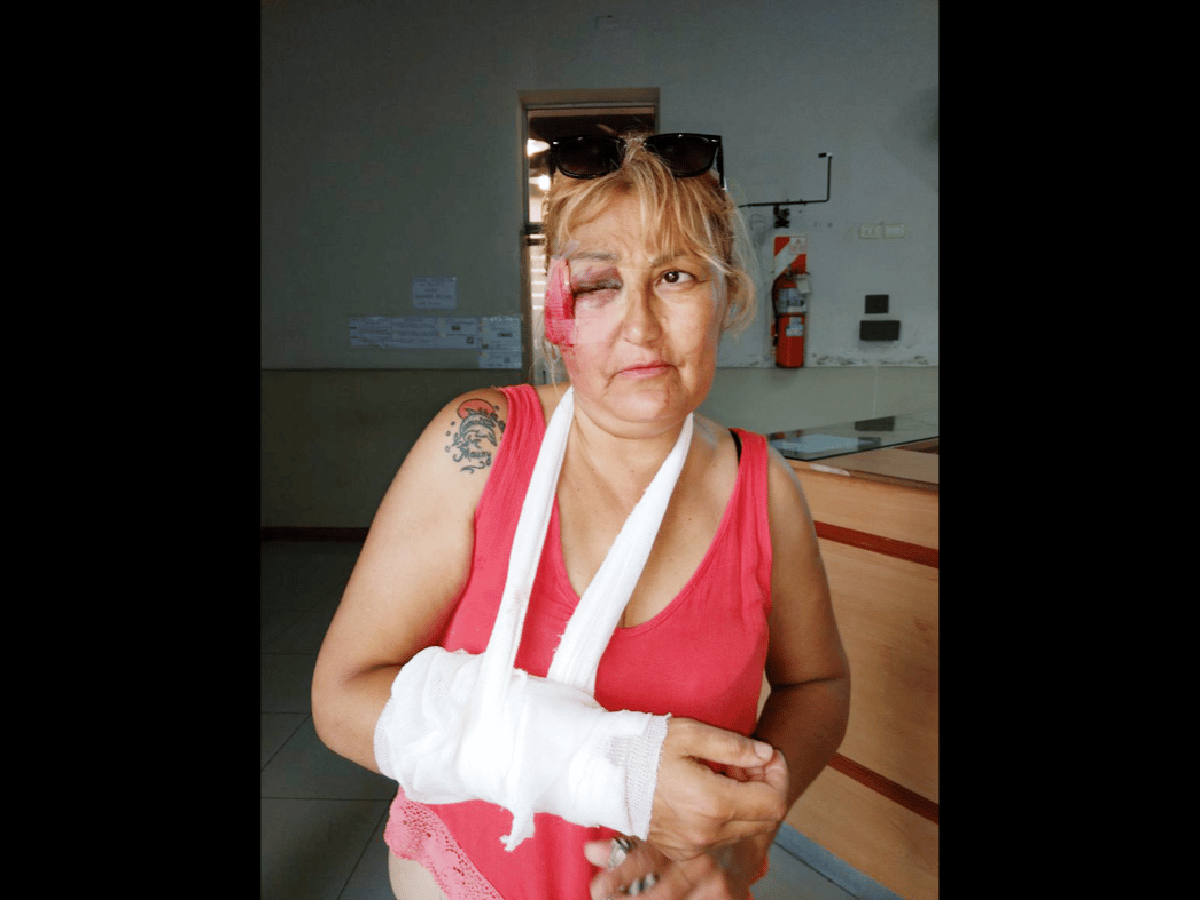 Una mujer fue víctima de un arrebato violento en barrio Hospital 