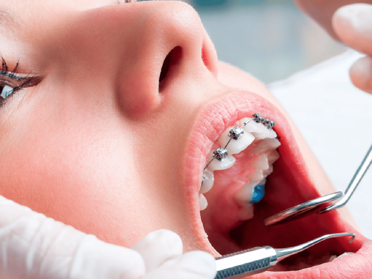 Investigadores de la Universidad de Córdoba desarrollan sistema de ortodoncia que reduce los tiempo de tratamiento