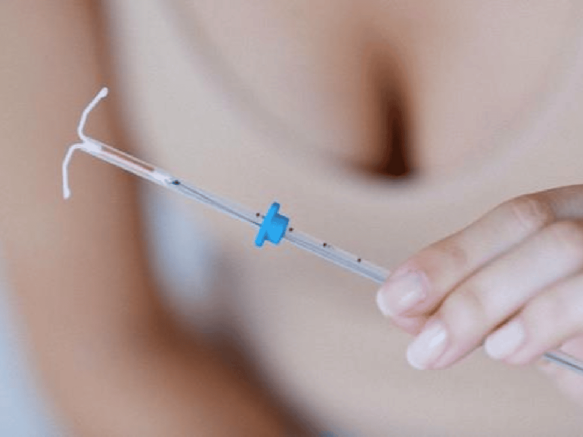El DIU posparto: una opción segura para la anticoncepción 