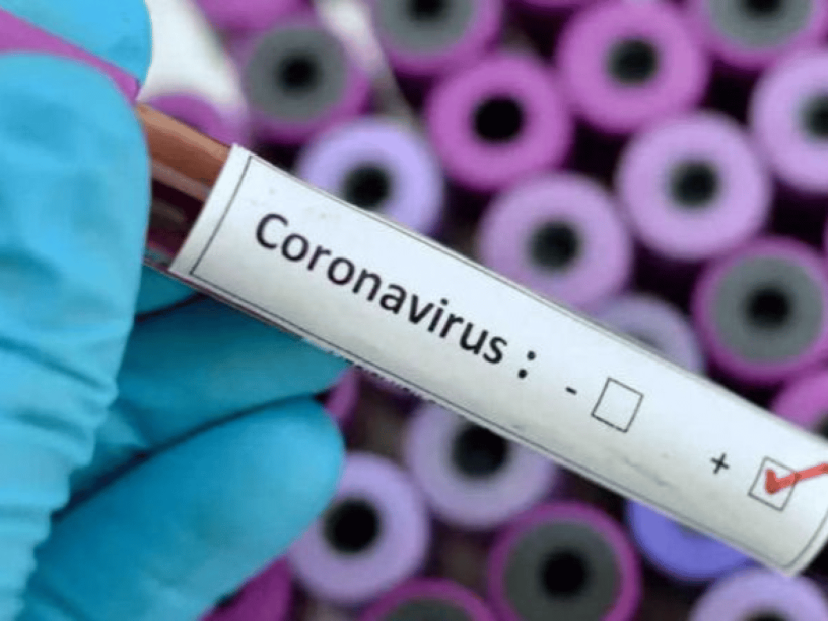 Dos nuevos casos de coronavirus en Morteros 