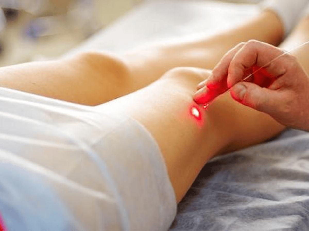 Tratamiento con láser, una solución segura  para las várices