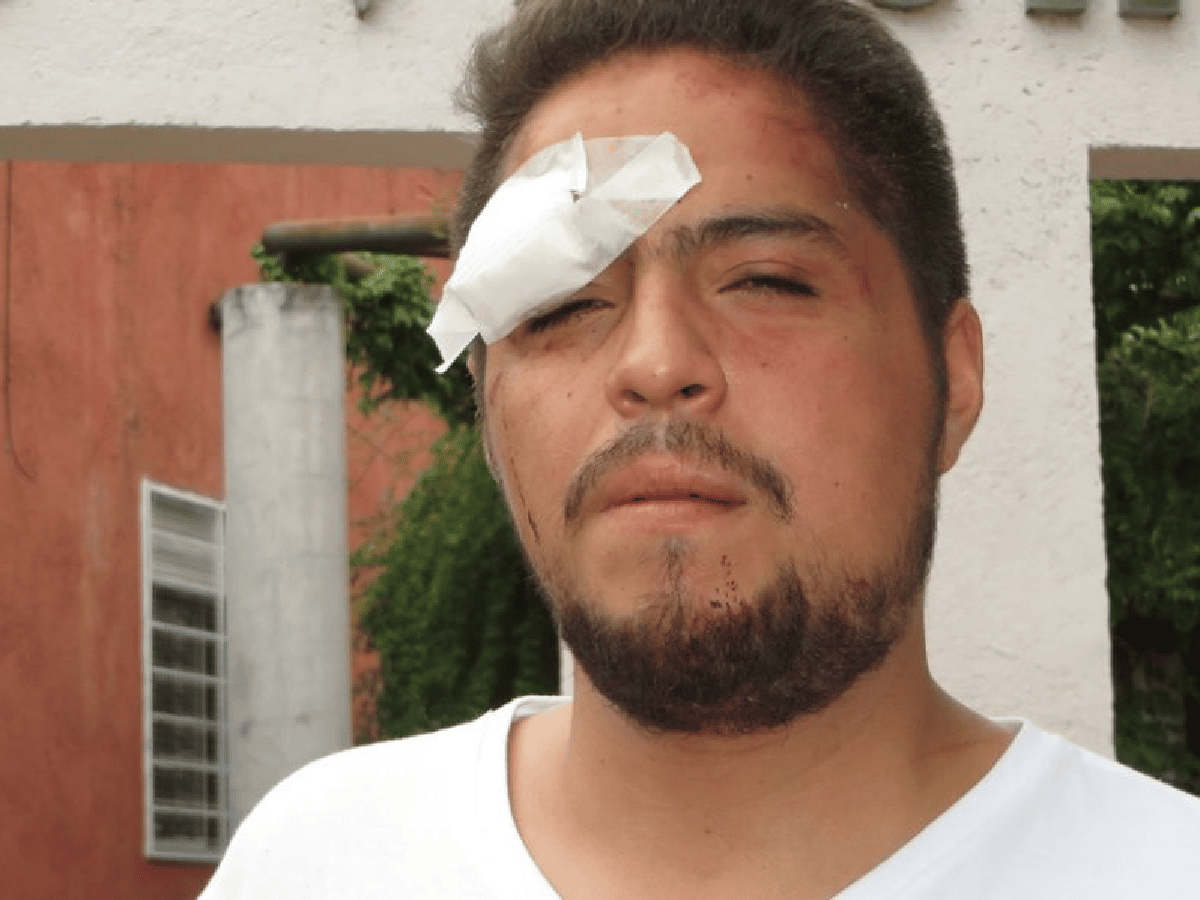 Joven sanfrancisqueño golpeado por policías confía en que la  Justicia de “una pena ejemplar”   
