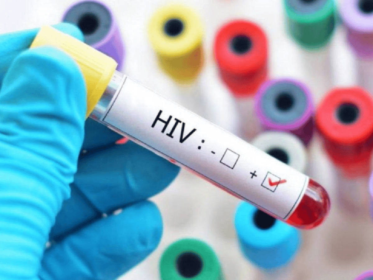 Curaron a una persona con VIH por segunda vez en la historia