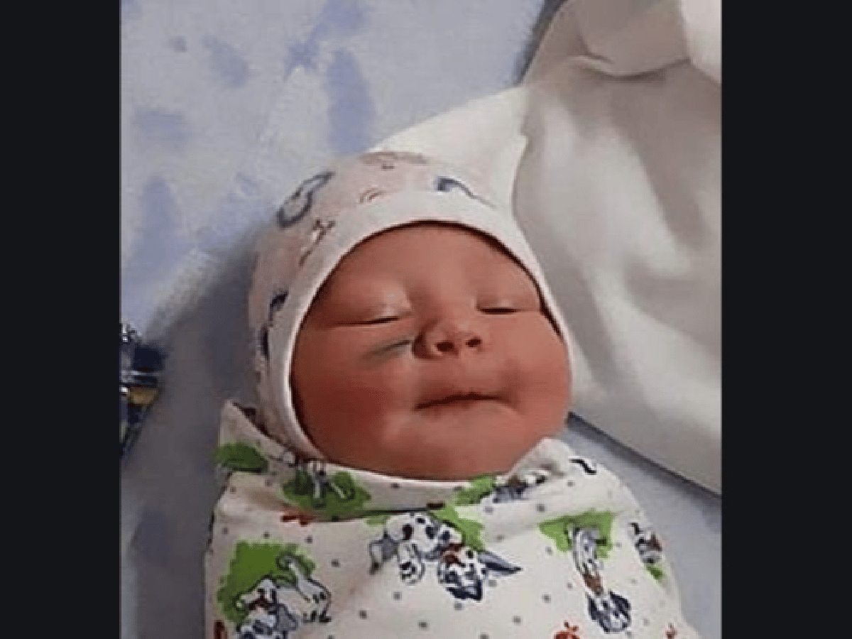 Insólito: los médicos lastimaron el rostro de una bebé durante la cesárea