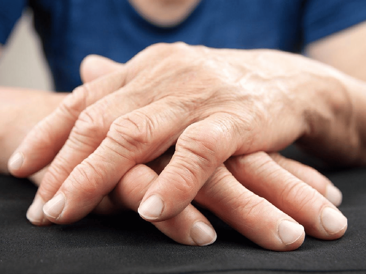 Tres de cada cuatro pacientes  con artritis reumatoidea padecen  la incomprensión de su entorno 