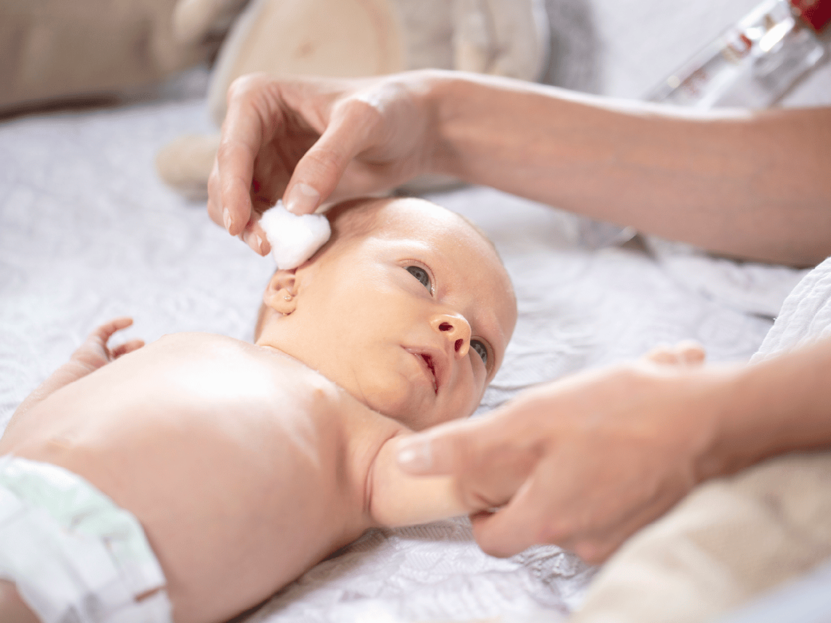 Cómo cuidar la piel del recién nacido 