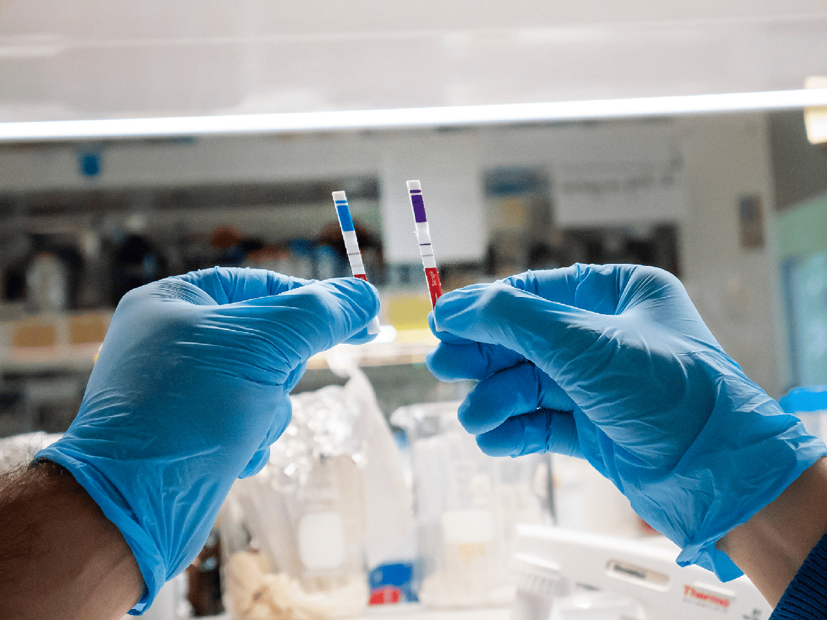 Desarrollan un test que detecta la presencia del virus cuatro veces más rápido que el PCR