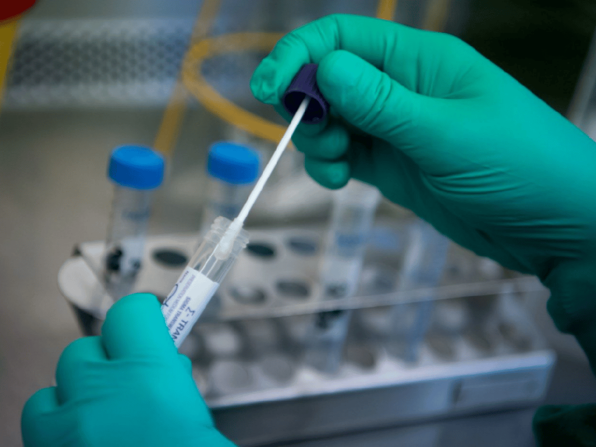 Facultan a las provincias a confirmar casos positivos de coronavirus sin la realización de un hisopado