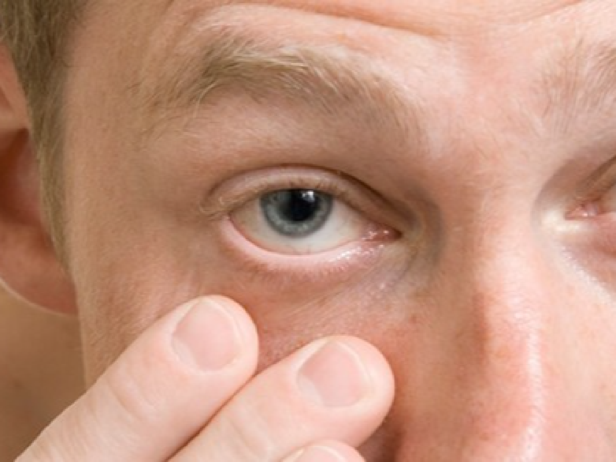 El 7% de infectados con covid presentarían síntomas oculares