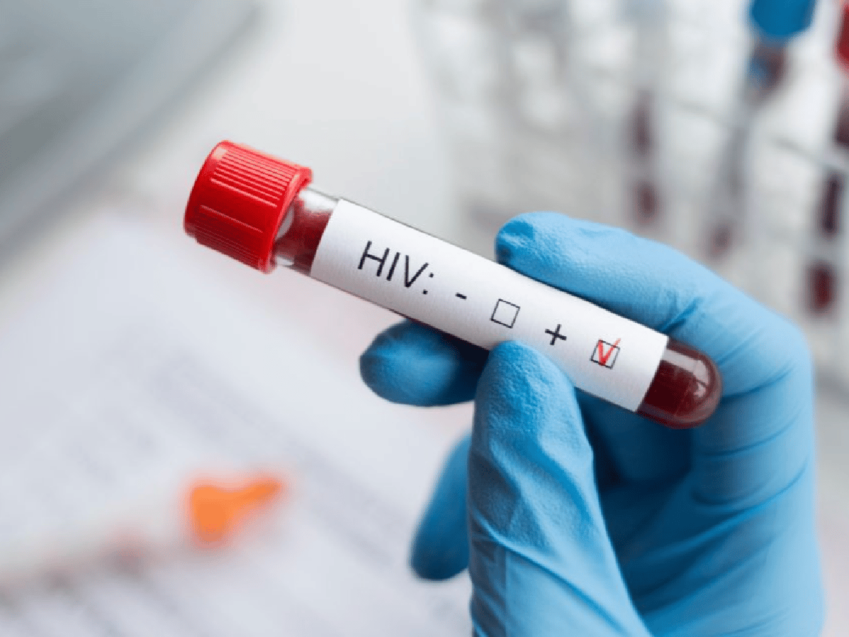 Europa: alertan por el avance del Sida mientras se está en plena lucha contra el coronavirus