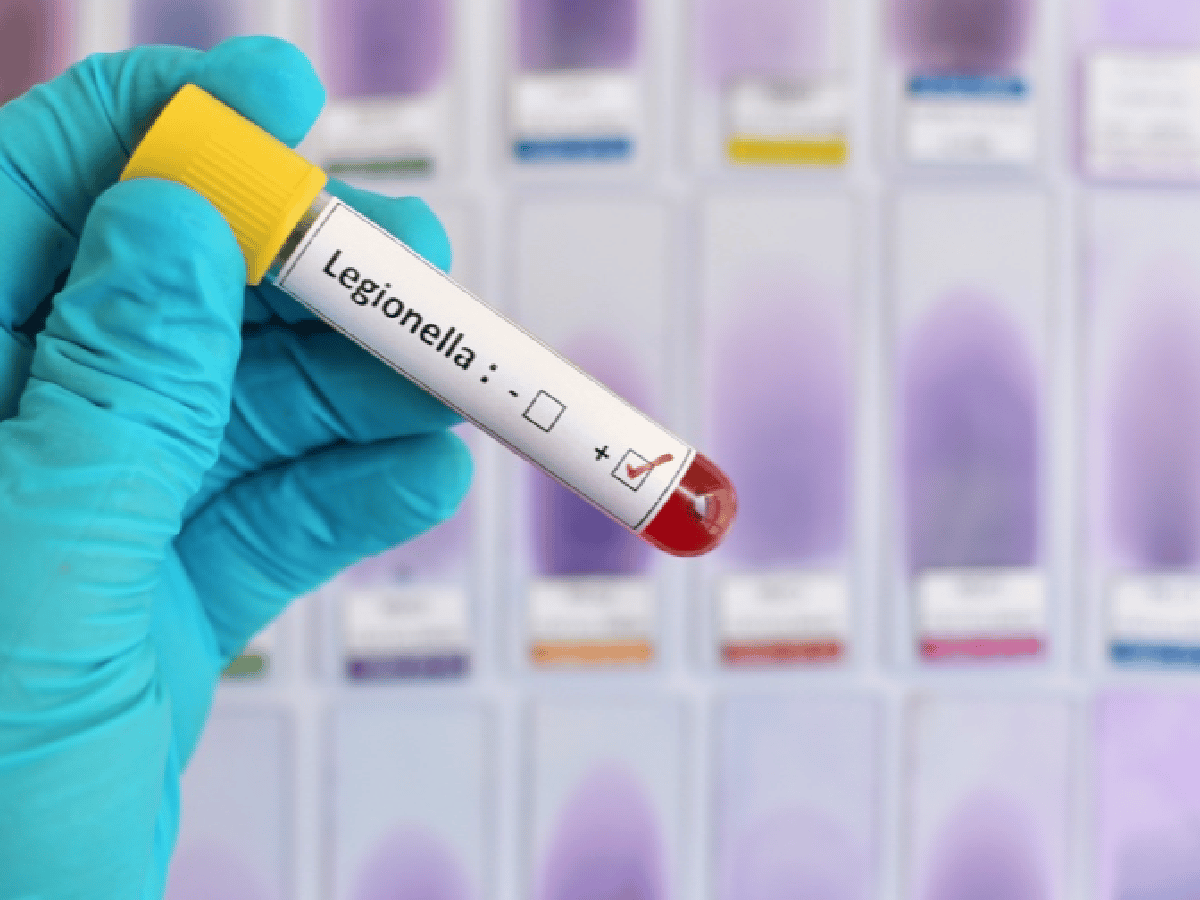 Claves para entender el  brote de la enfermedad del Legionario  