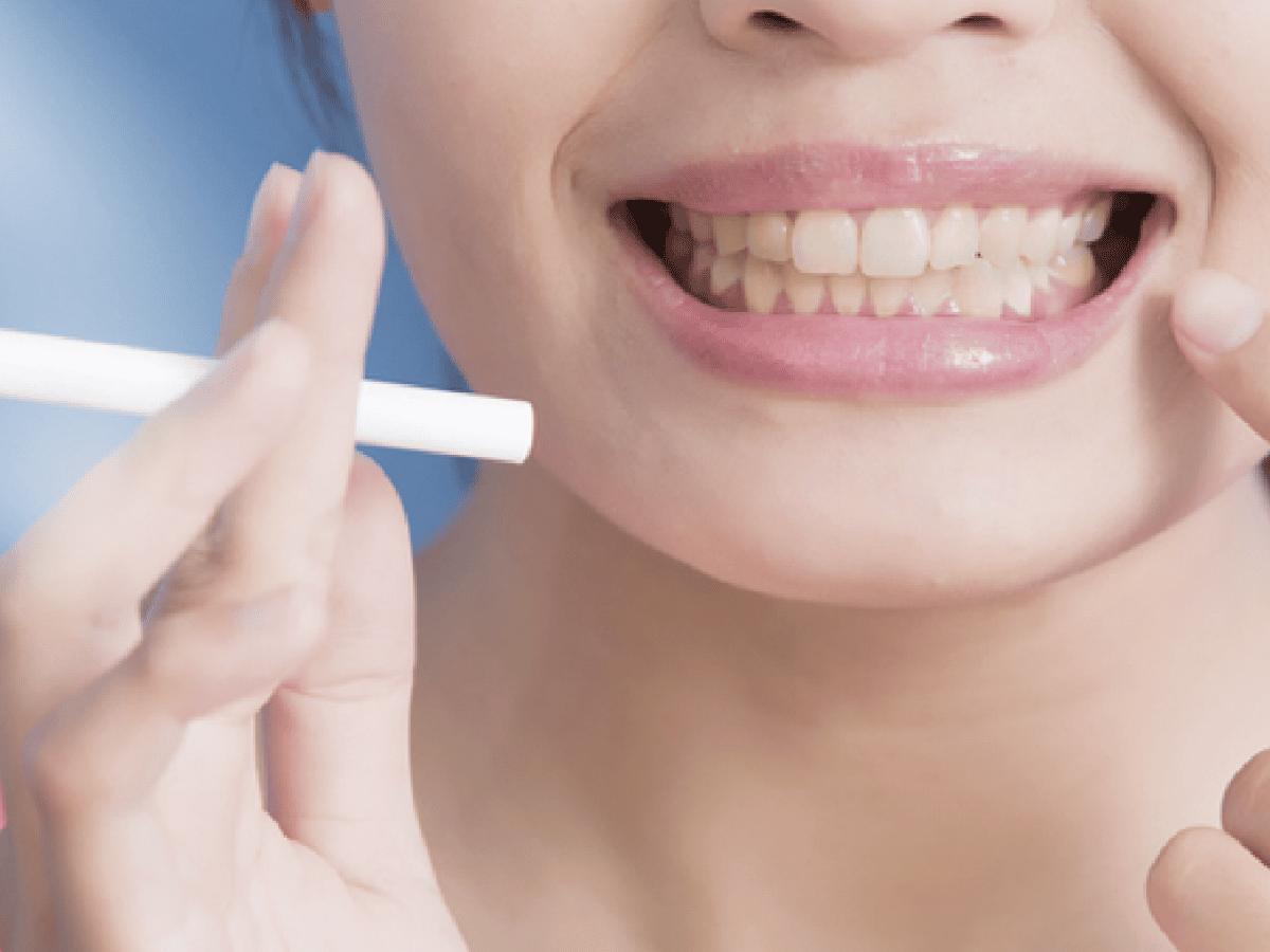 Día Mundial sin Tabaco  -  El impacto de fumar en la salud bucal    