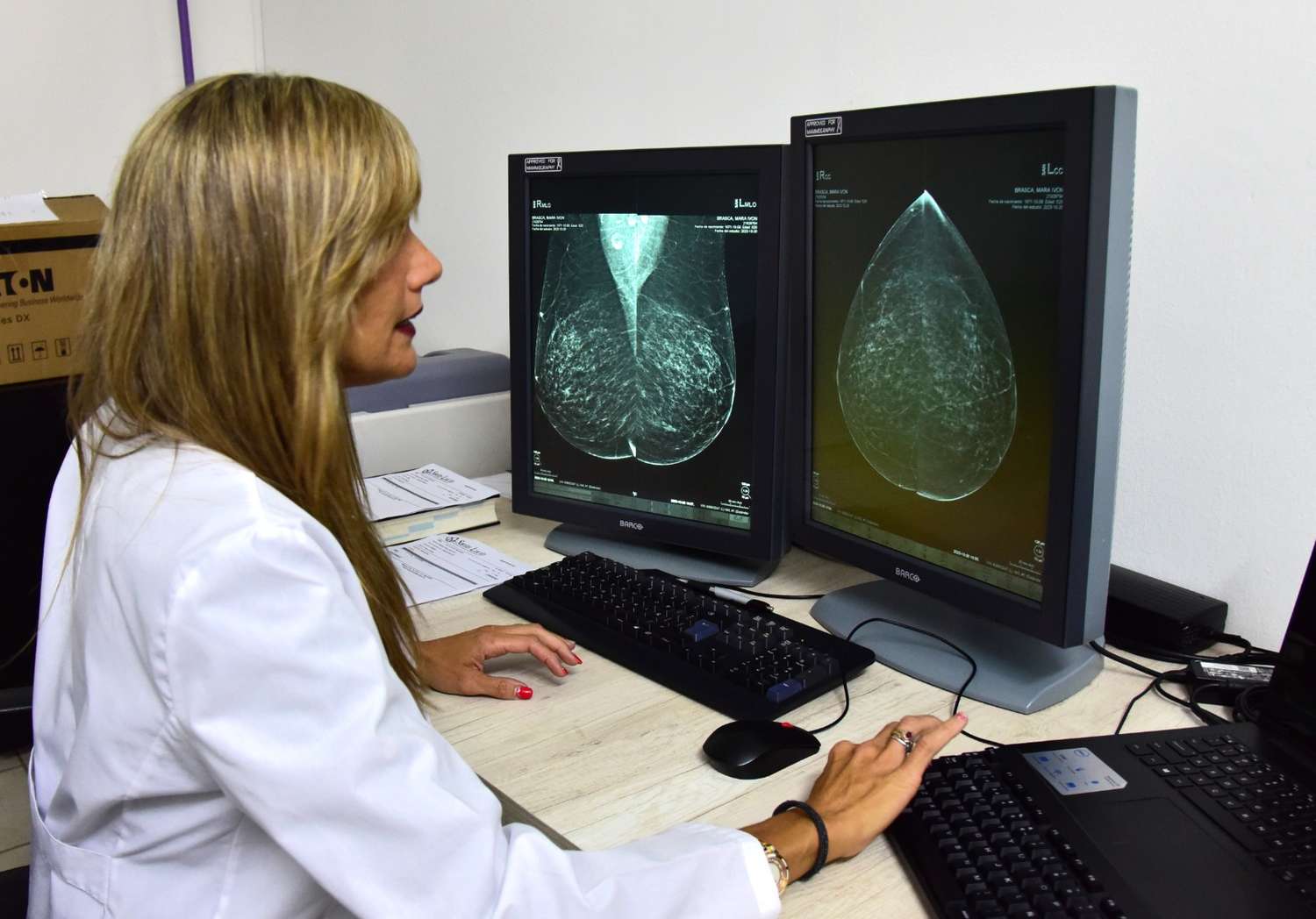 mamografía 3D